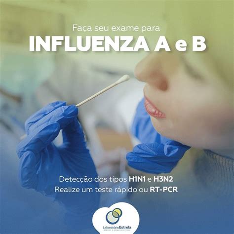Como É Feito O Exame De Influenza