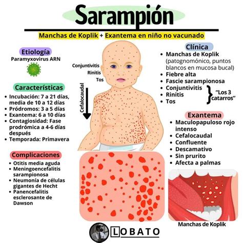 Sarampi N Exantemas Pediatr A Cl Nica Etiolog A Incubaci N