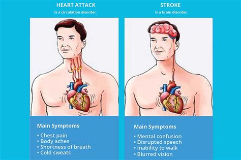 Stroke What is the difference between a heart attack and a stroke?