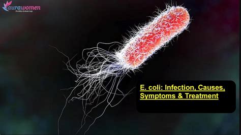 E. coli: Infection, Causes, Symptoms & Treatment | Aurawomen