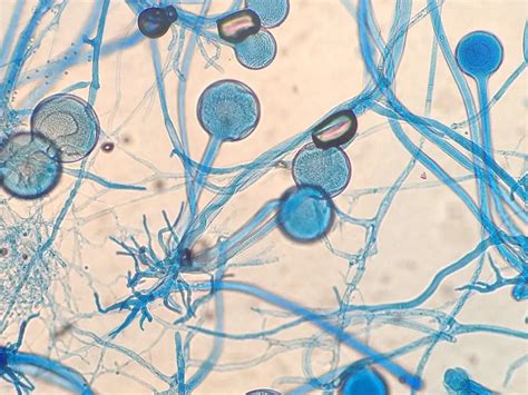 10 most famous mold fungi and their danger to humans – Healthy Food Near Me
