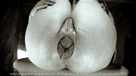 REALLY EXTREME ANAL Pics XHamster