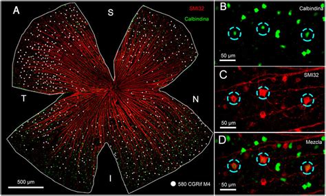 A Photomontage Of A Pigmented Mouse Retina Showing Retinal Ganglion