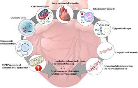 Pathophysiological Mechanism Of Myocardial Ischemia Reperfusion Injury