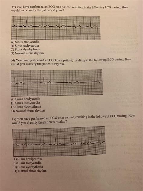 Solved 12) You have performed an ECG on a patient, resulting | Chegg.com