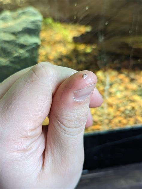 How Do You Tell If Its A Freshwater Limpet Or Just A Regular Snail R
