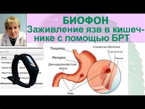 Приборы БИОМЕДИС | BIOMEDIS. Биорезонансная терапия. Биофон. Заживление ...