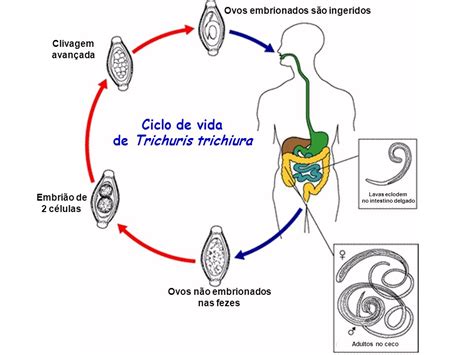 Trichuris Trichiura Tricuríase Enterobius Vermicularis Oxiuríase Ppt Video Online Carregar