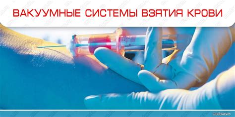 Вакуумные пробирки
