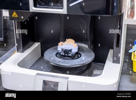 Dental 3d Scanner Dental Scan With Prosthesis Create Three