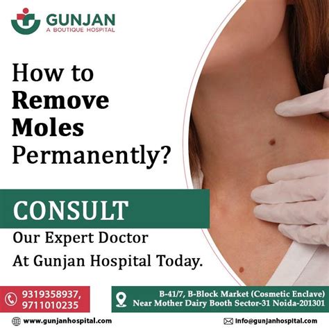 Say goodbye to moles with our permanent removal treatment at Gunjan ...