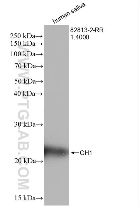 Growth Hormone antibody (82813-2-RR) | Proteintech