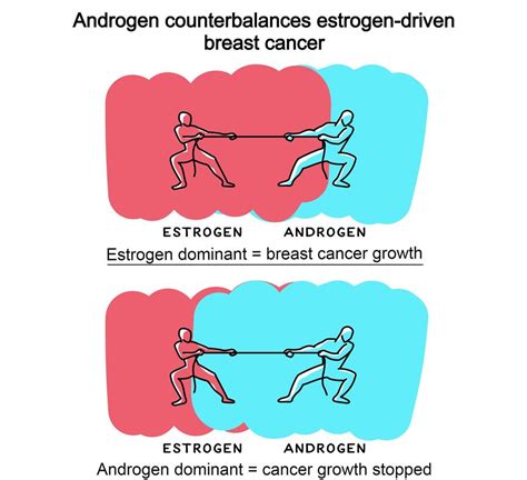 Male Sex Hormones Can Help Treat Breast Cancer Cyber Rt