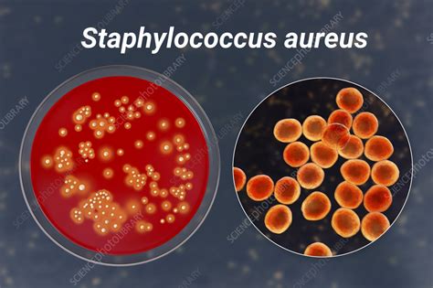 Staphylococcus Aureus Bacteria Illustration Stock Image F0373656