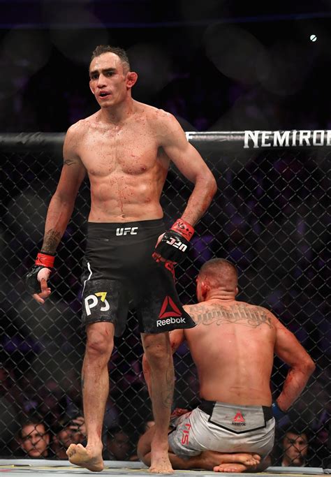 Anthony Pettis Ethnicity