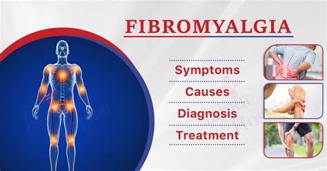 Fibromyalgia Diagnosis And Treatment