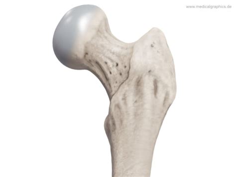 Free Illustration Femoral Head And Neck Front