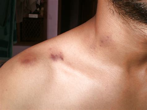 Love Bites Porn Pictures XXX Photos Sex Images 1297436 PICTOA