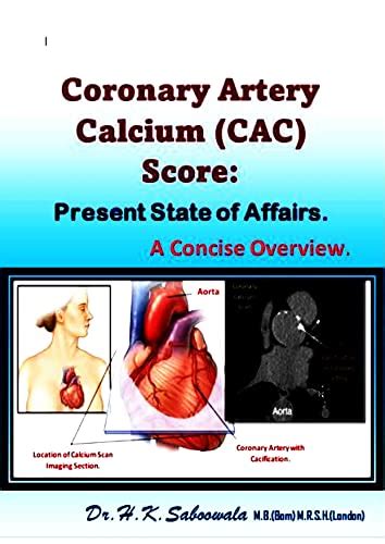 Coronary Artery Calcium Cac Score Present State Of Affairs A