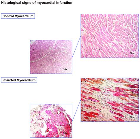 Myocardium