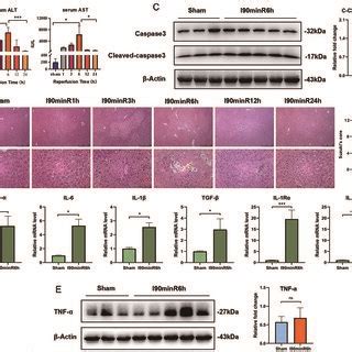 Expression Of Apoptosis And Inflammatory Factors Increased In Clinical