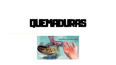 Quemaduras Erickson Vaca Udocz