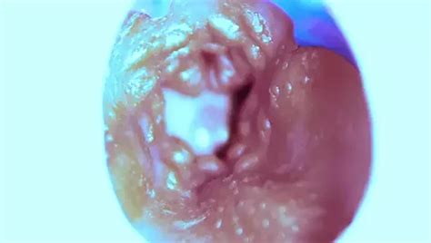 Camera Inside Pussy Powerfull Cum In Pussy Best Internal Asmr In 4k More Sperm Gay Porn XHamster