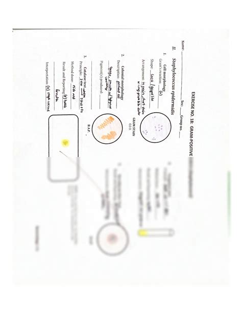 SOLUTION: Bacteriology Lab worksheet: Gram Positive Cocci ...