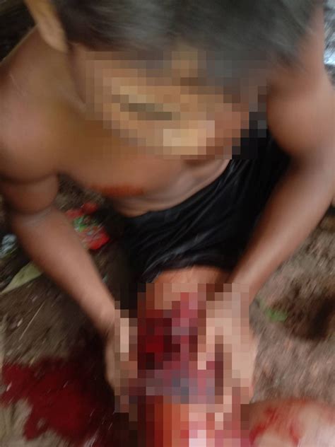 Doo Tha Htoo District Incident Report Two Villagers Were Injured As A