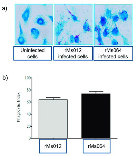 Phagocytic Activity Of J A Macrophages Infected With Rms And