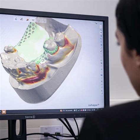 Cadcam Dental Prosthesis Subcontracting