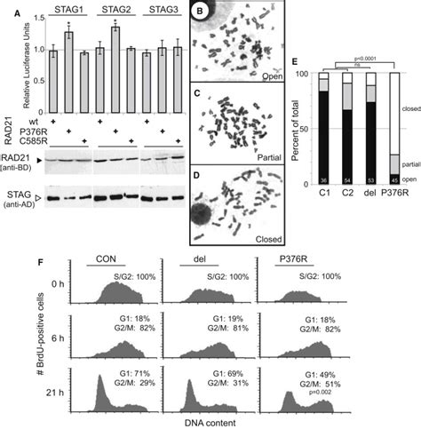 Rad Mutations Cause A Human Cohesinopathy The American Journal Of