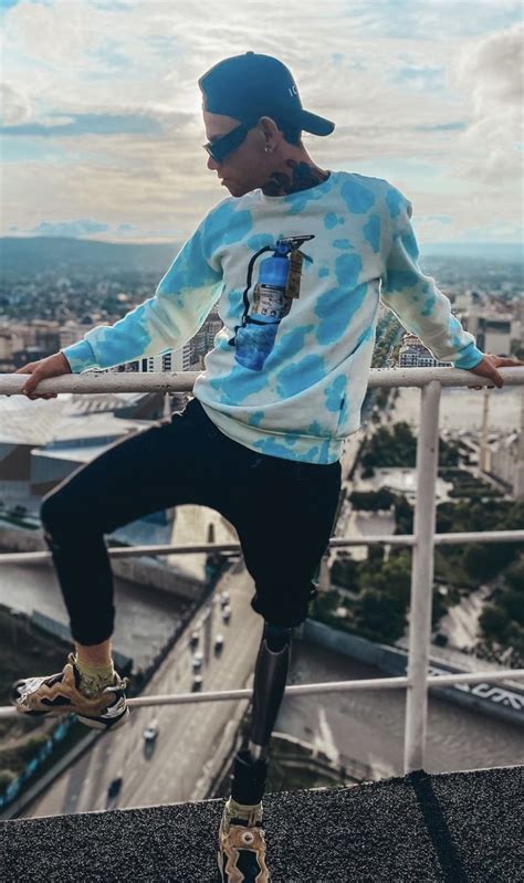 Gay Amputee Fetichism And Others