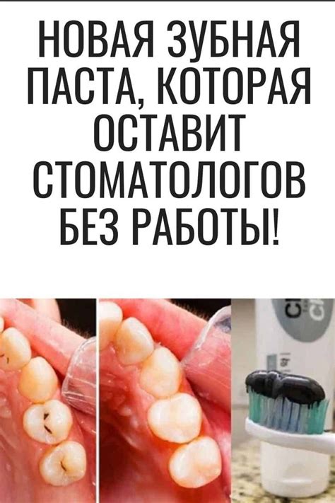 Новая зубная паста, которая оставит стоматологов без работы! | Зубная ...