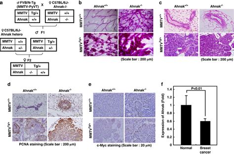 Tumor Suppressive Effect Of Ahnak A Mating Strategy For Making