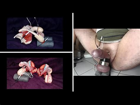 Electrical Stimulation Of The Testicles Xvideos