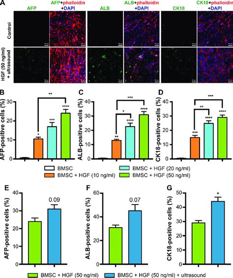 Expressions Of Hepatic Differentiation Markers Afp Alc And Ck Were