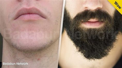 Los 5 trucos más efectivos para hacer crecer tu barba de forma natural