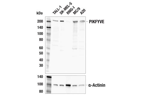 Pikfyve E4x3r Rabbit Mab Cell Signaling Technology