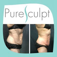 55 PureSculpt Ice Hieloterapia Ideas Pure Products Body Contouring