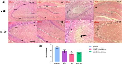 Photomicrographs of hippocampal tissue stained with H&E (a) H&E ...