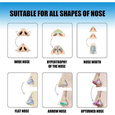 Nose Shapes Chart