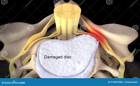 The Cervical Nerves are the Spinal Nerves from the Cervical Vertebrae ...