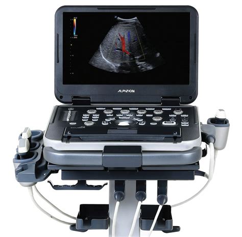 Alpinion E Cube I7 Ultrasound Machine For Sale Uds