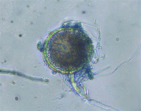 trichoderma asperellum fungus attacking  phytophthora ramorum