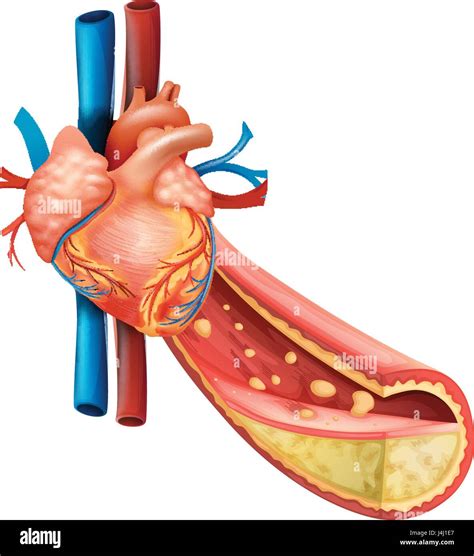 Diagrama Que Muestra El Corazón Humano Y Vetas De Grasa Ilustración