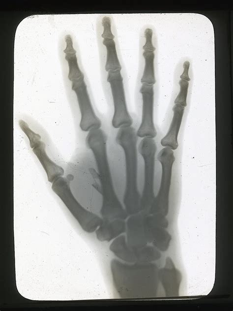 Lot Rare Lantern Glass Photograph X Ray Hand 19th C