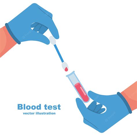 El Médico Sostenga En La Mano Una Muestra De Sangre En Un Tubo De