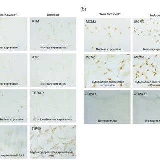 Expression Of Proteins Involved In Dna Damage Signaling Chromatin