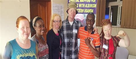 My Life As A Person With Albinism In Uganda Two Women Share Their